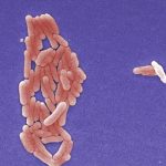 CDC investigating mysterious salmonella outbreak in 25 states