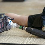 Government overpaid millions for veterans’ prosthetic devices: Report